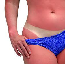 Cuidados no Verão: O que fazer em caso de insolação! Quando alguém se expõe ao sol por muito tempo em dias de calor forte, o organismo começa a suar numa tentativa de manter a temperatura baixa. O suor excessivo, no...
