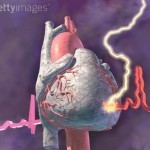 Colesterol: o que a hiperlipidemia pode causar?